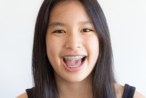 adjust to teen dental braces lawrenceville orthodontists
