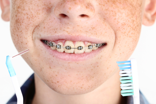 get braces before summer lawrenceville orthodontists