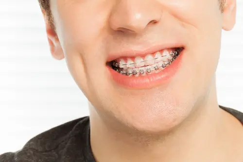 braces and Invisalign Teen for teenagers Lawrenceville Orthodontics