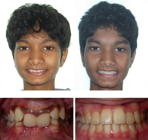 Akhil
